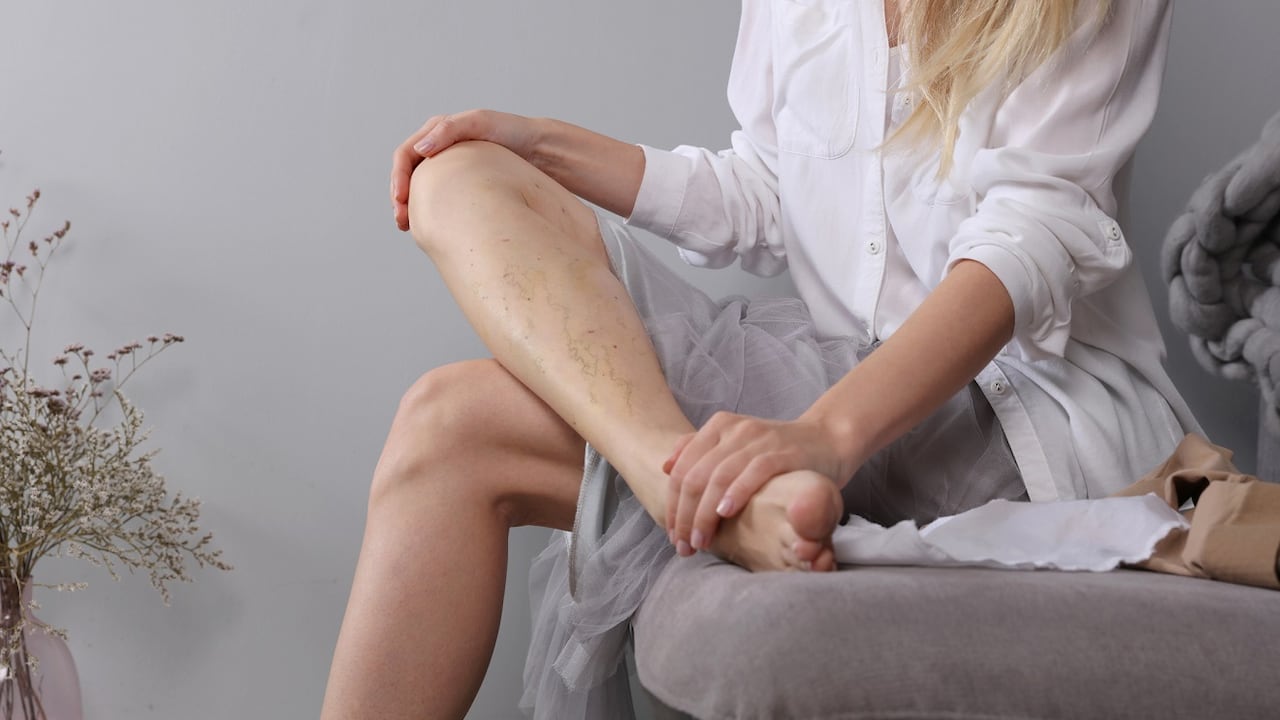 Las piernas son de las partes del cuerpo que más afectan por una mala circulación.