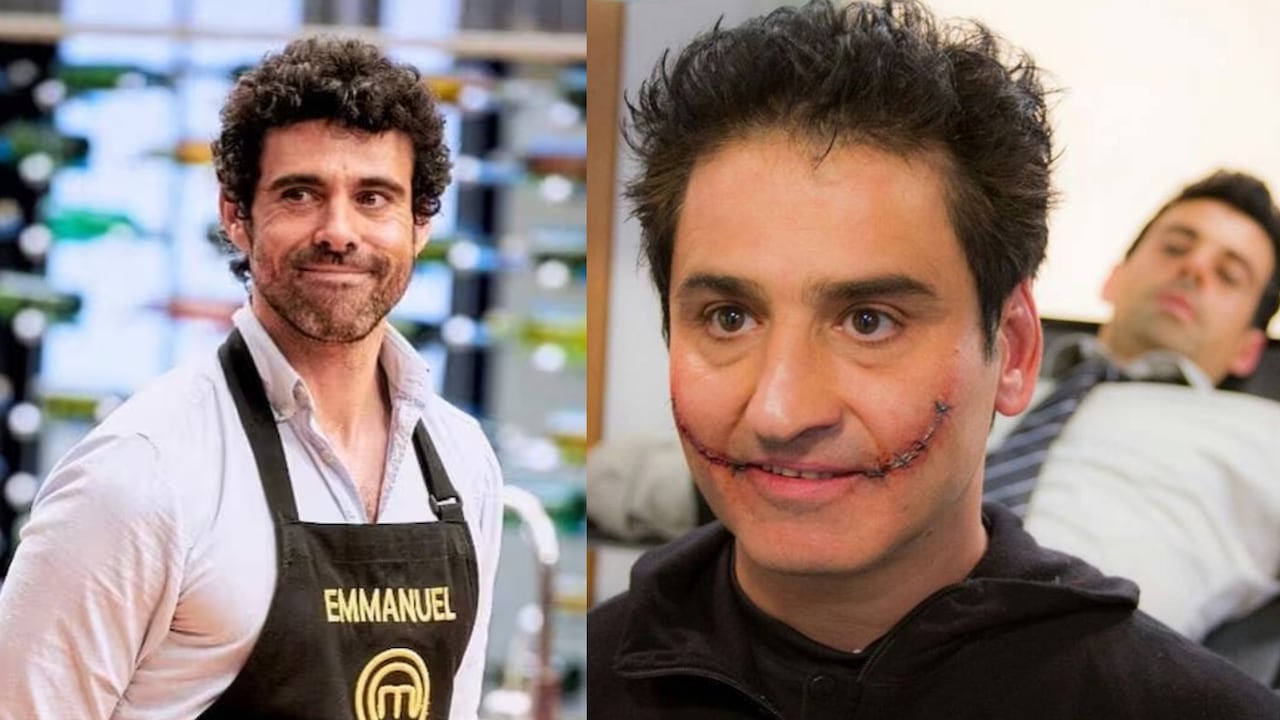 Emmanuel Esparza se sincera sobre Robinson Díaz