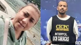 Yulixa Toloza y el supuesto cirujano que le practicó el procedimiento estético en Bogotá.