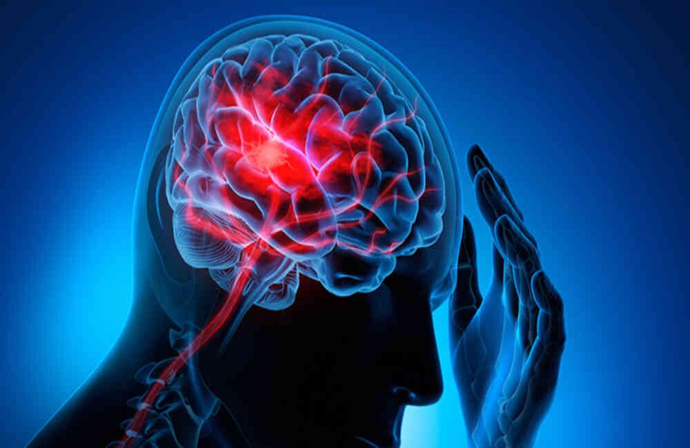 Cerca de 15 millones de personas sufren un ataque cerebrovascular (ACV) cada año.