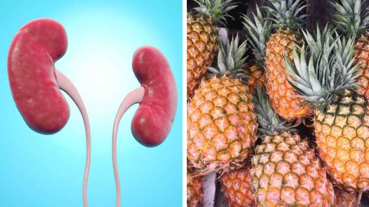 La piña contiene bromelina, la cual es excelente para combatir infecciones o inflamaciones de los riñones. Foto: Getty Images. Montaje Semana.