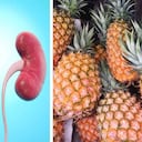 La piña contiene bromelina, la cual es excelente para combatir infecciones o inflamaciones de los riñones. Foto: Getty Images. Montaje Semana.