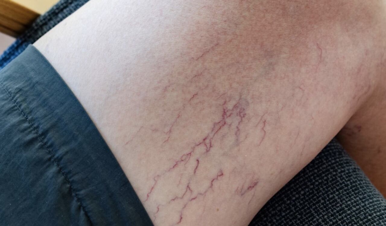 Tomar semillas de lino o linaza ayuda a tener una mejor circulación de la sangre.