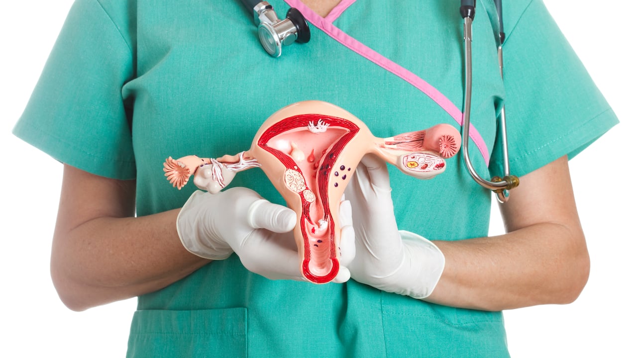 Cáncer ginecológico.