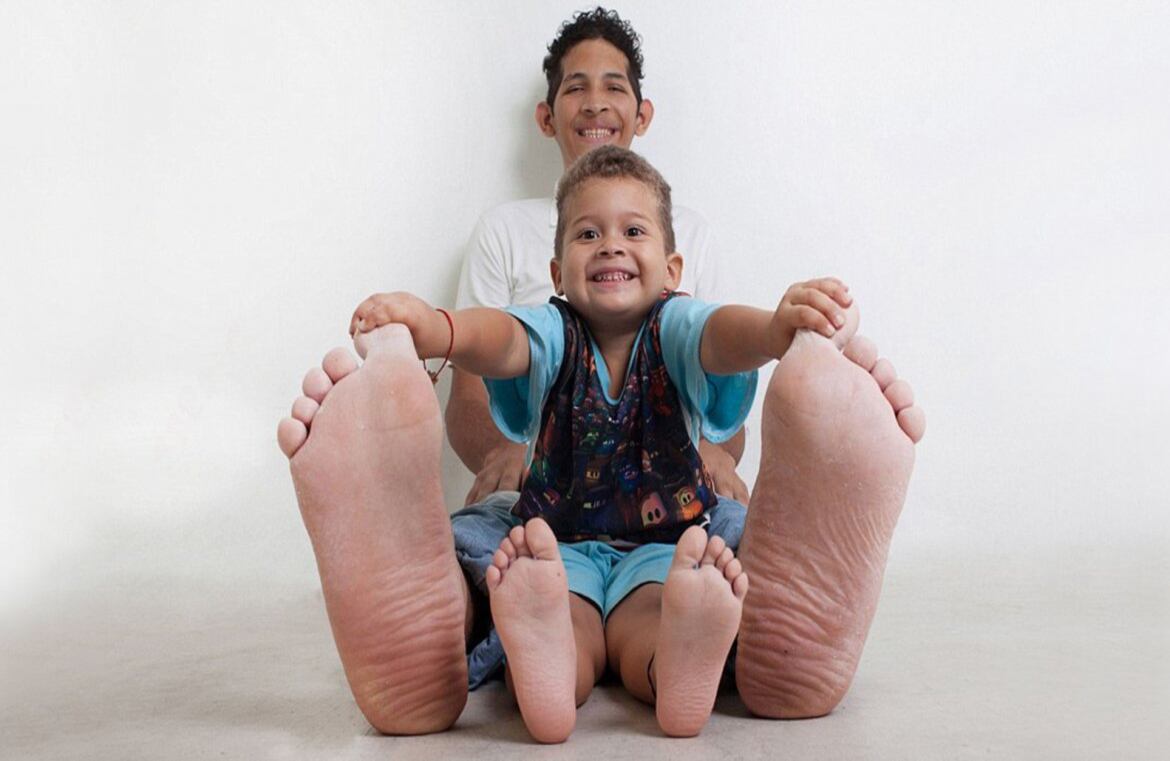 El venezolano Jeison Orlando Rodríguez Hernández tiene los pies más grandes del mundo. 40.1 cm mide su pie derecho, y 39.6 cm el izquierdo.