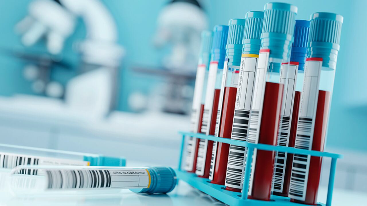 Unos 2,2 millones de personas que viven con el virus en Latinoamérica, de acuerdo con cifras del informe En peligro, difundido en julio de 2022 por Onusida, entidad según la cual en 2021 esta región registró 110.000 nuevas infecciones.