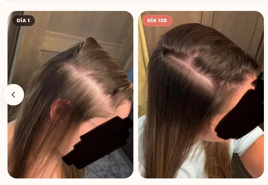 Invima advierte riesgos a la salud por el uso de suplemento para el cabello sin registro sanitario.