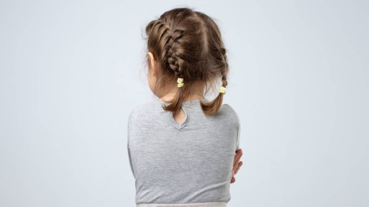 La australiana sufrió un golpe en la nunca cuando tenía aproximadamente dos años (imagen de referencia).