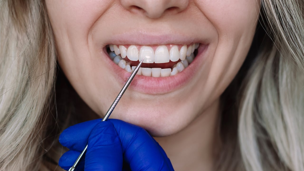 Estudio sobre envejecimiento dental. (Imagen de referencia).