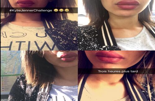Esta joven expresó su arrepentimiento en seguir el "#KylieJennerChallenge" a través de los emoticones en llanto. En la parte inferior afirma que sus labios seguían en el mismo estado tres horas después.