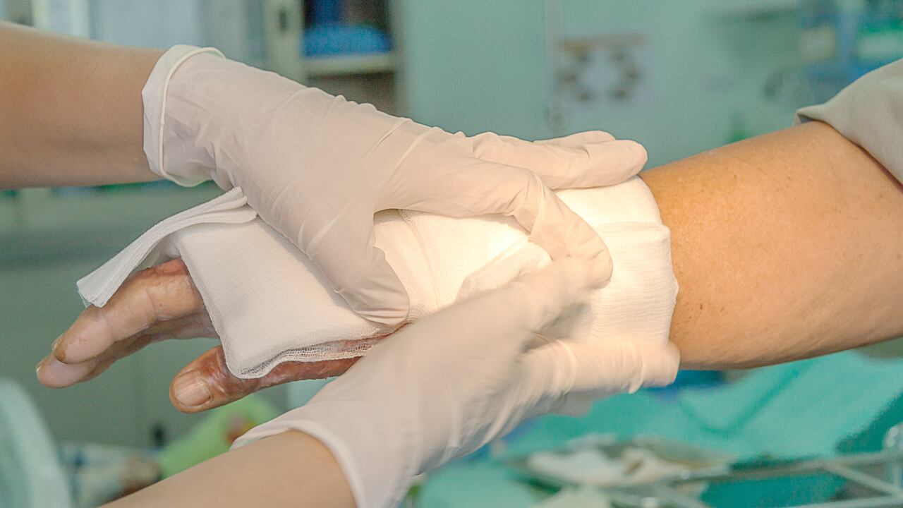 Con corte al 30 de diciembre, el Instituto Nacional de Salud ha confirmado 642 lesionados con pólvora.