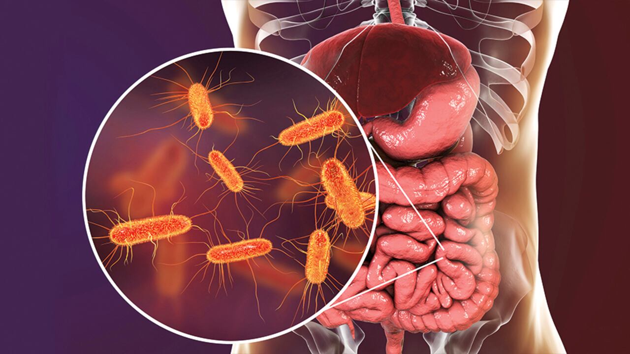 El cáncer es una enfermedad en la que células anómalas se dividen sin control y destruyen los tejidos corporales.