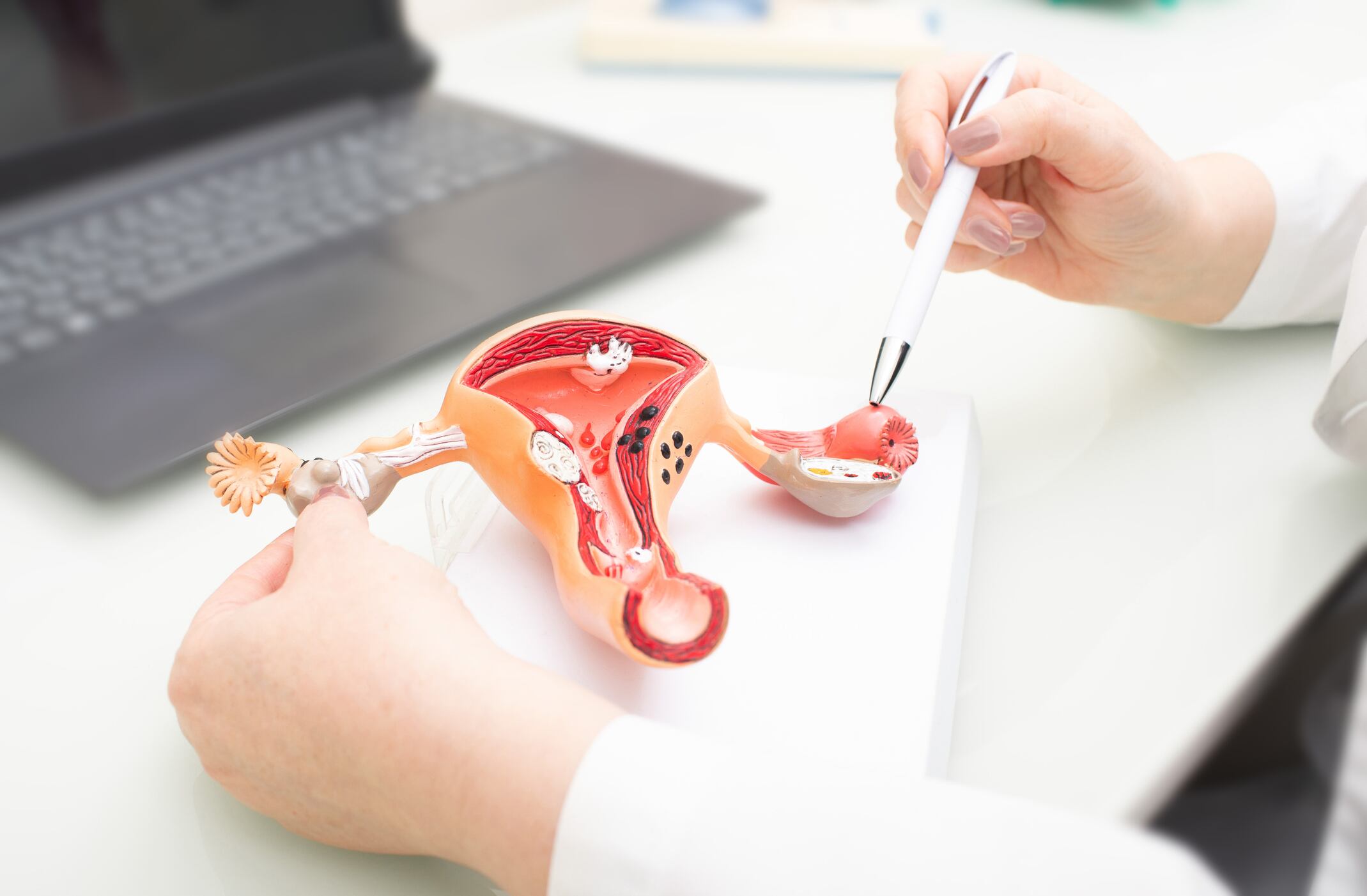 Gynecologist showing uterine structure on a uterus model. Uterus model on gynecologist's desk close-up