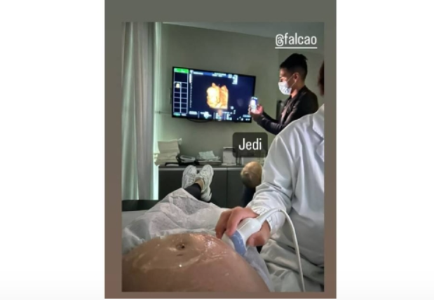 Bebé de Falcao y Lorelei