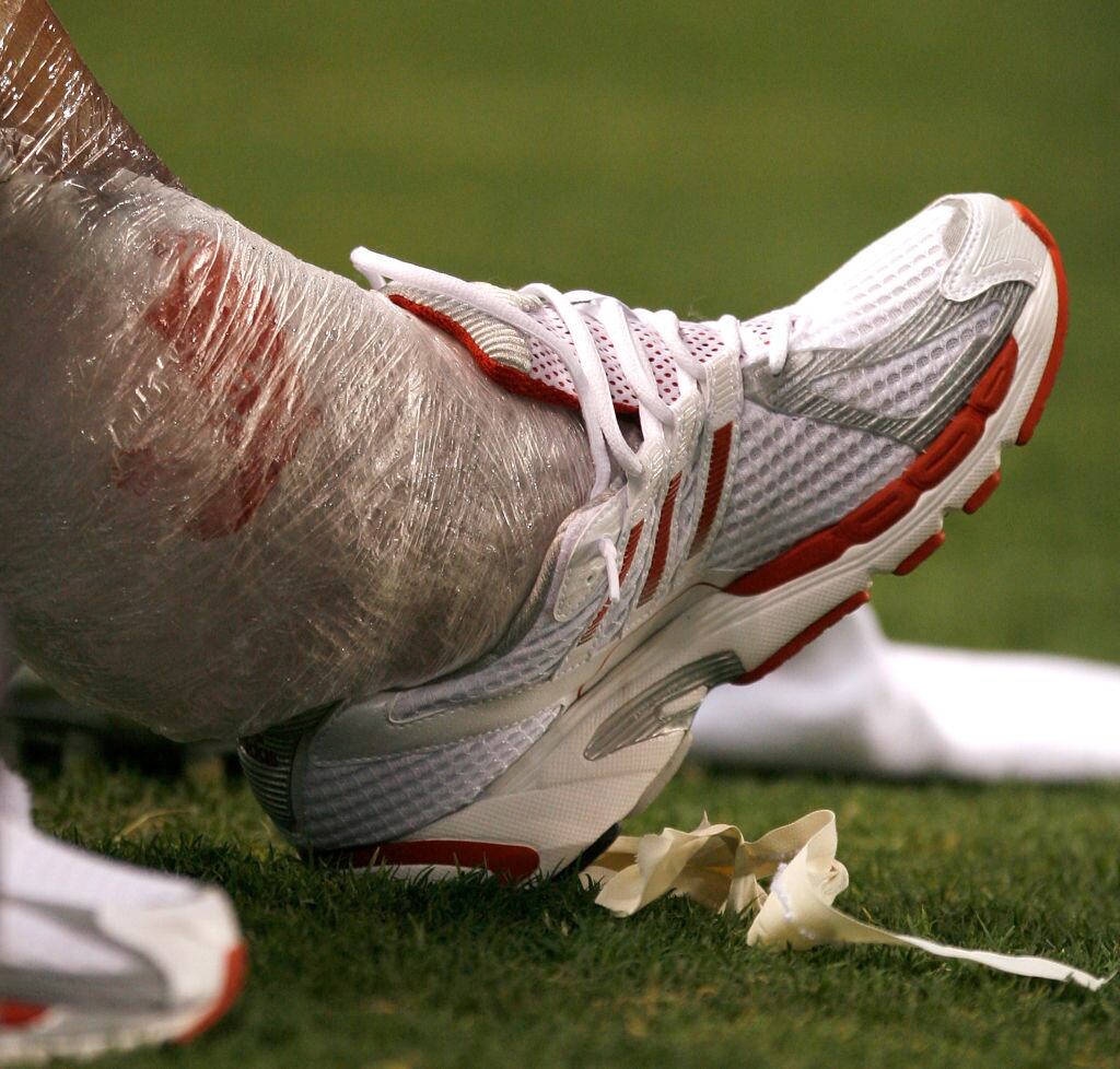 El tobillo lesionado de David Beckham, #23 de Los Angeles Galaxy, está envuelto en hielo mientras se sienta en el banquillo durante la segunda mitad de su concurso contra D.C. United en la SuperLiga en el Home Depot Center, el 15 de agosto de 2007 en Carson, California. (Foto de Steve Grayson/WireImage)