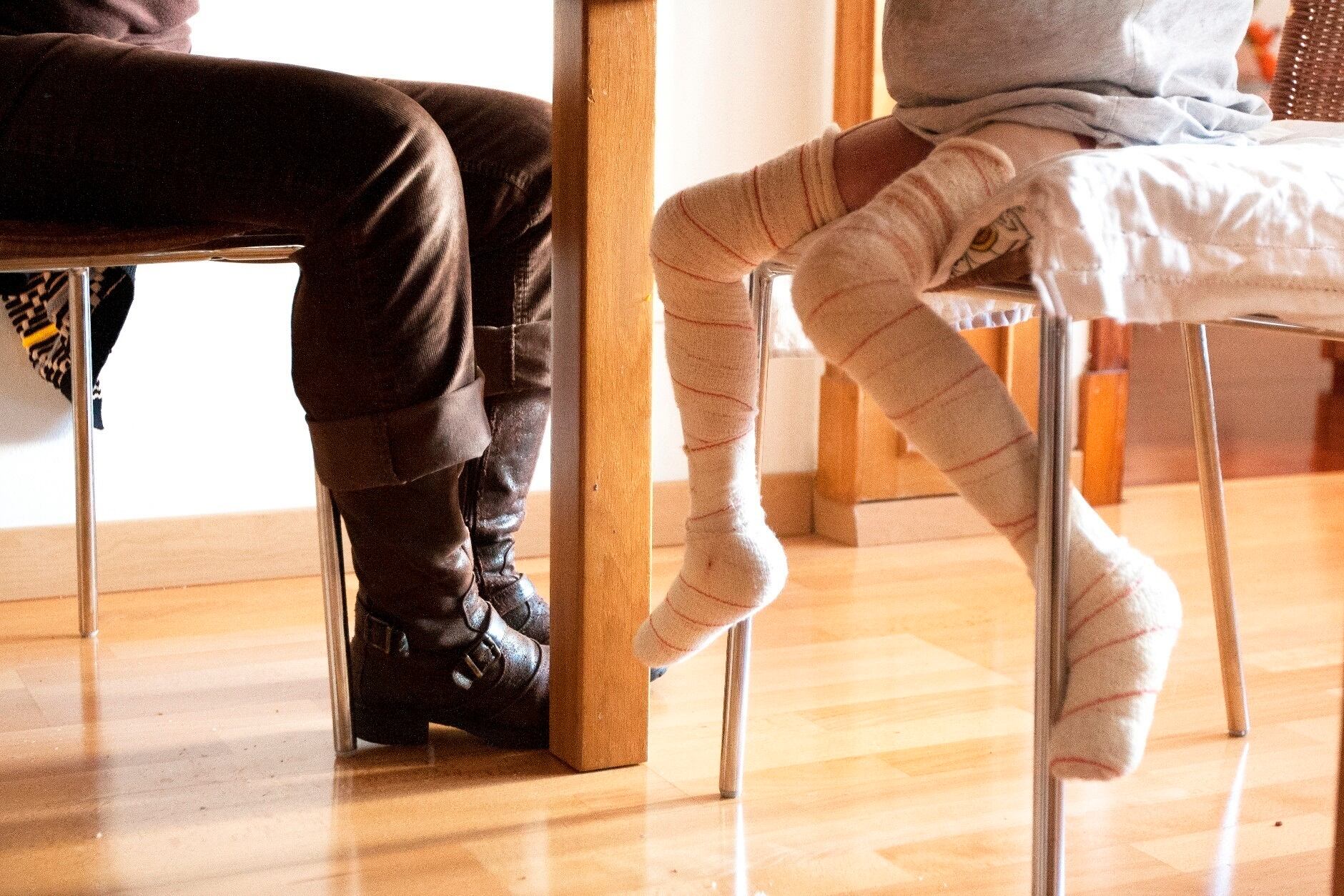 epidermólisis bullosa