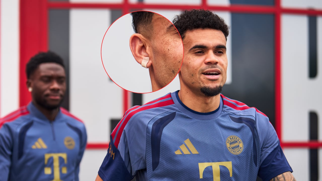 Luis Díaz apareció con una cinta en su oreja. Se supo la explicación médica que tiene previo al juego de Champions League