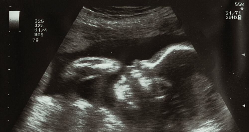 Las enfermedades congénitas afectan cada vez a más recién nacidos. 