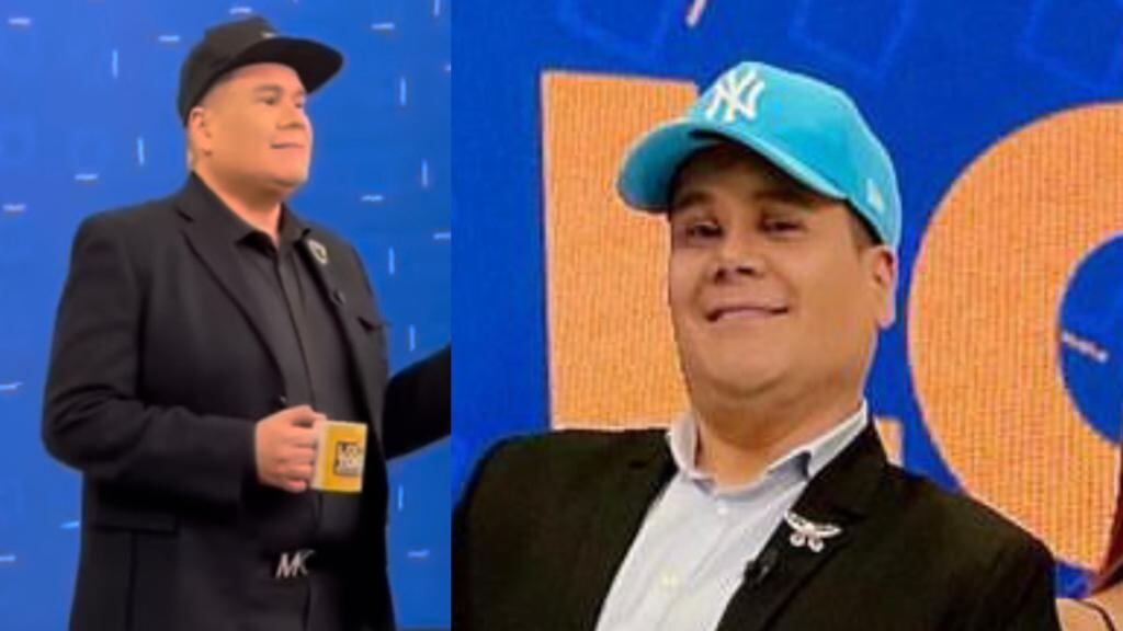 ¿Ariel Osorio se quedó calvo? La razón por la que no se quita la gorra en Lo Sé Todo
