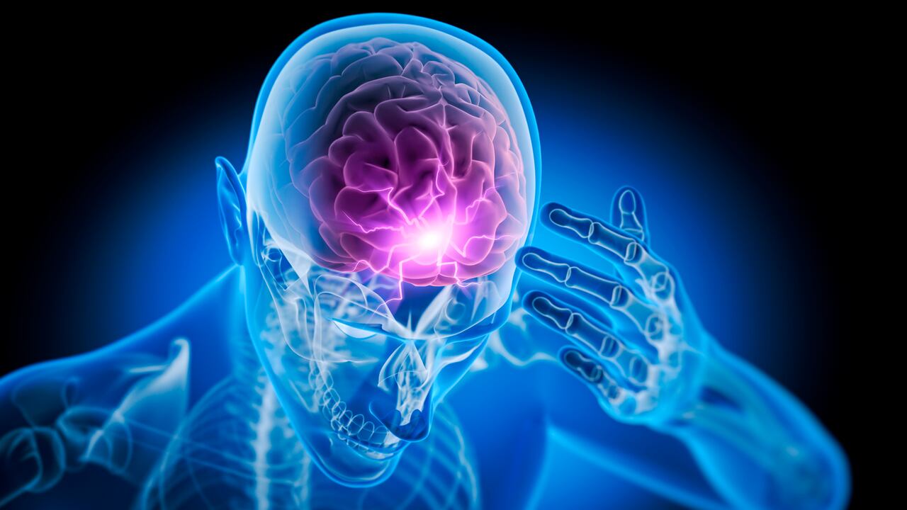 Ilustración médica de rayos X de un hombre con fuerte dolor de cabeza - Ilustración 3D