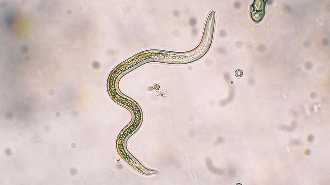 Parásitos intestinales.