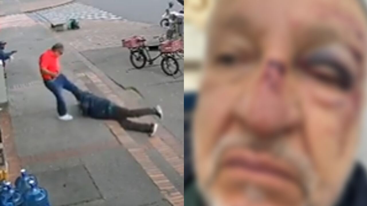 La hija de la víctima que sufrió la violenta agresión, compartió fotos de cómo quedó su papá.