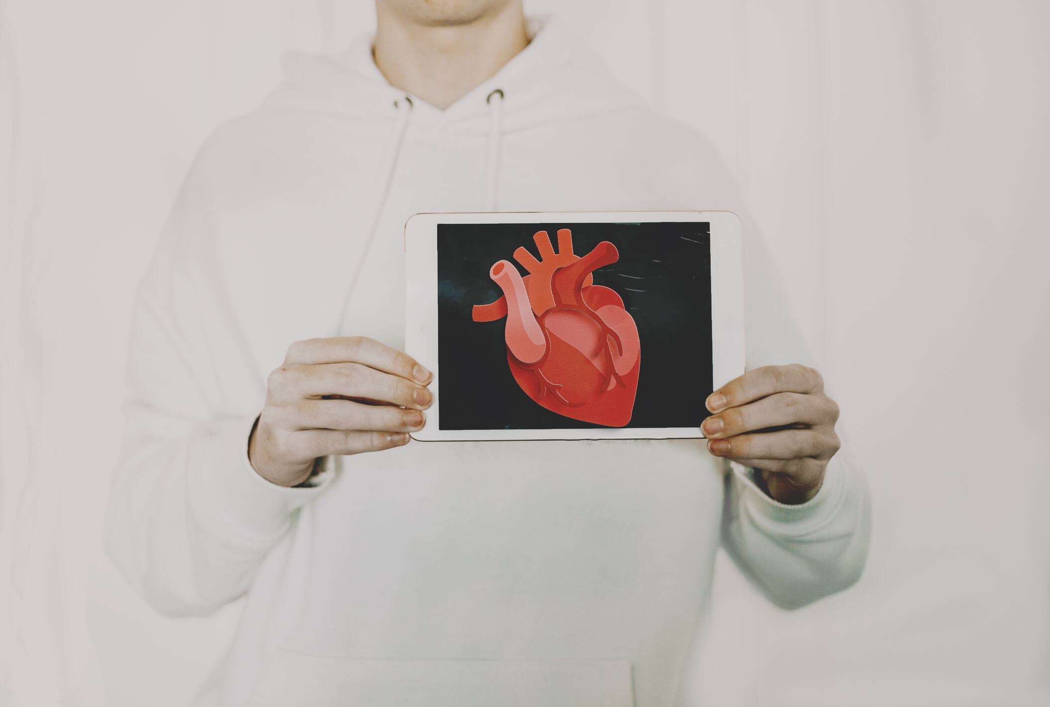 Donación de órganos.