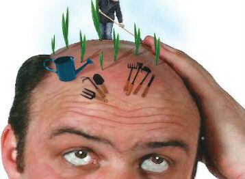 Las cuarentenas y el teletrabajo se convirtieron en una oportunidad para los tratamiento capilares, pues los pacientes se podían hacer el trasplante sin tener que pedir permiso en la oficina.