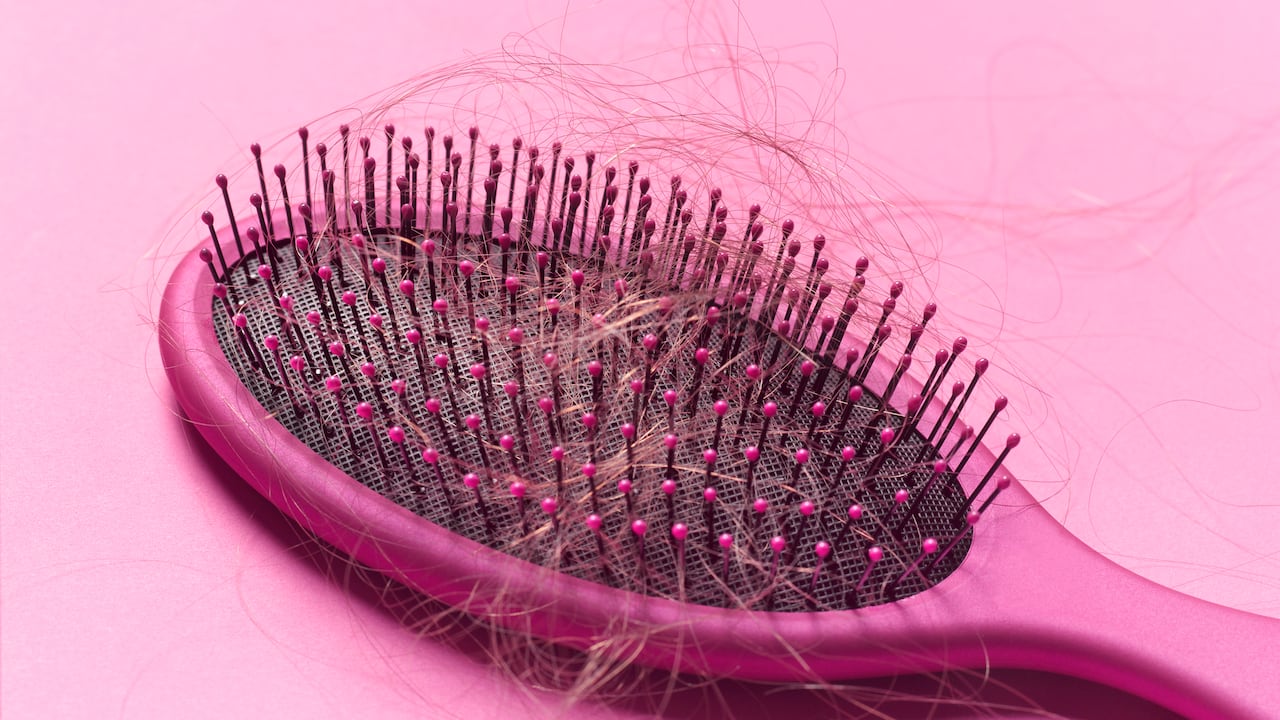 Foto de referencia sobre pérdida de cabello