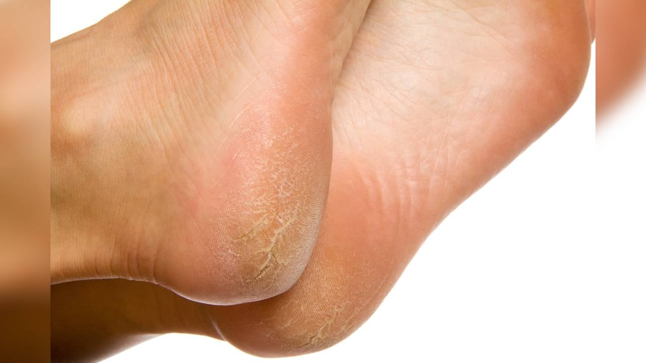 La piel de los pies también debe hidratarse.