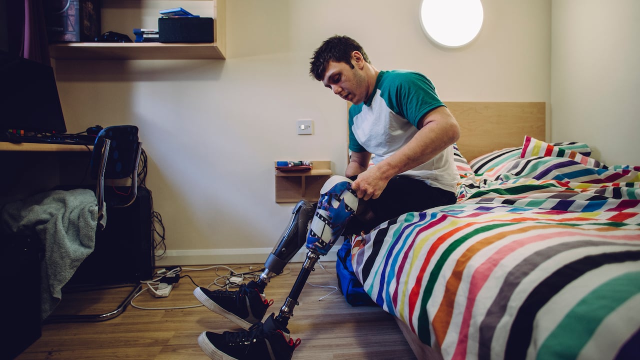 En algunos casos la meningitis puede generar la pérdida de extremidades.