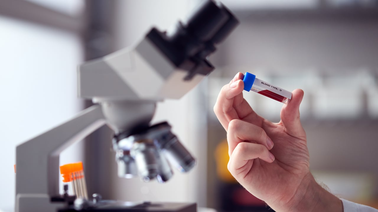 Investigadores trabajan en el cultivo de glóbulos rojos Rh-nulo, la sangre más rara del mundo, en busca de crear una fuente segura y universal para pacientes con tipos sanguíneos incompatibles.