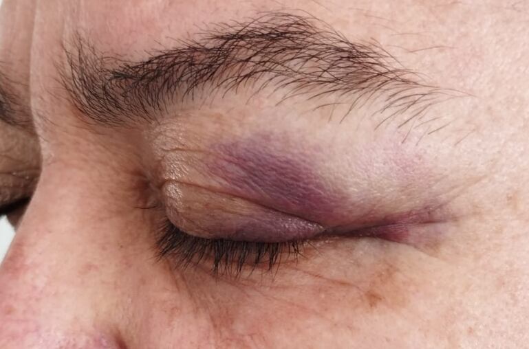 El hecho ocurrió en medio de una verbena popular.