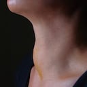 Frente al hipotiroidismo (cuando no produce suficiente hormona tiroidea), los síntomas se relacionan con una disminución en la actividad funcional de todos los sistemas del organismo.