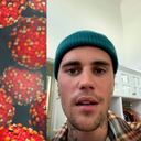 El síndrome de Ramsay Hunt ocurre en personas que han tenido varicela. Justin Bieber anunció recientemente que lo padece.