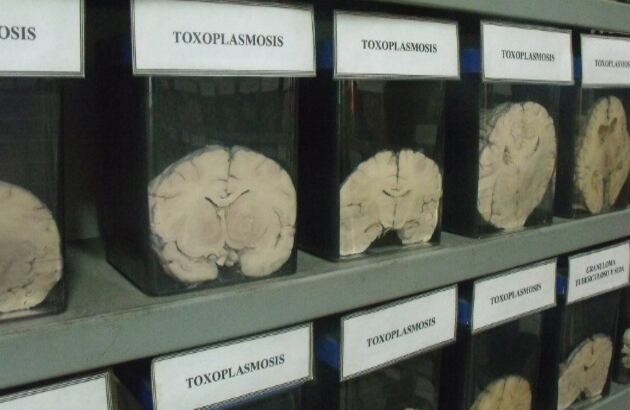 Quienes visitan el Museo del Cerebro en Lima afirma que es una experiencia no apta para personas sensibles. Hay una gran variedad de cerebros con impresionantes lesiones. Aquí algunos con toxoplasmósis. 