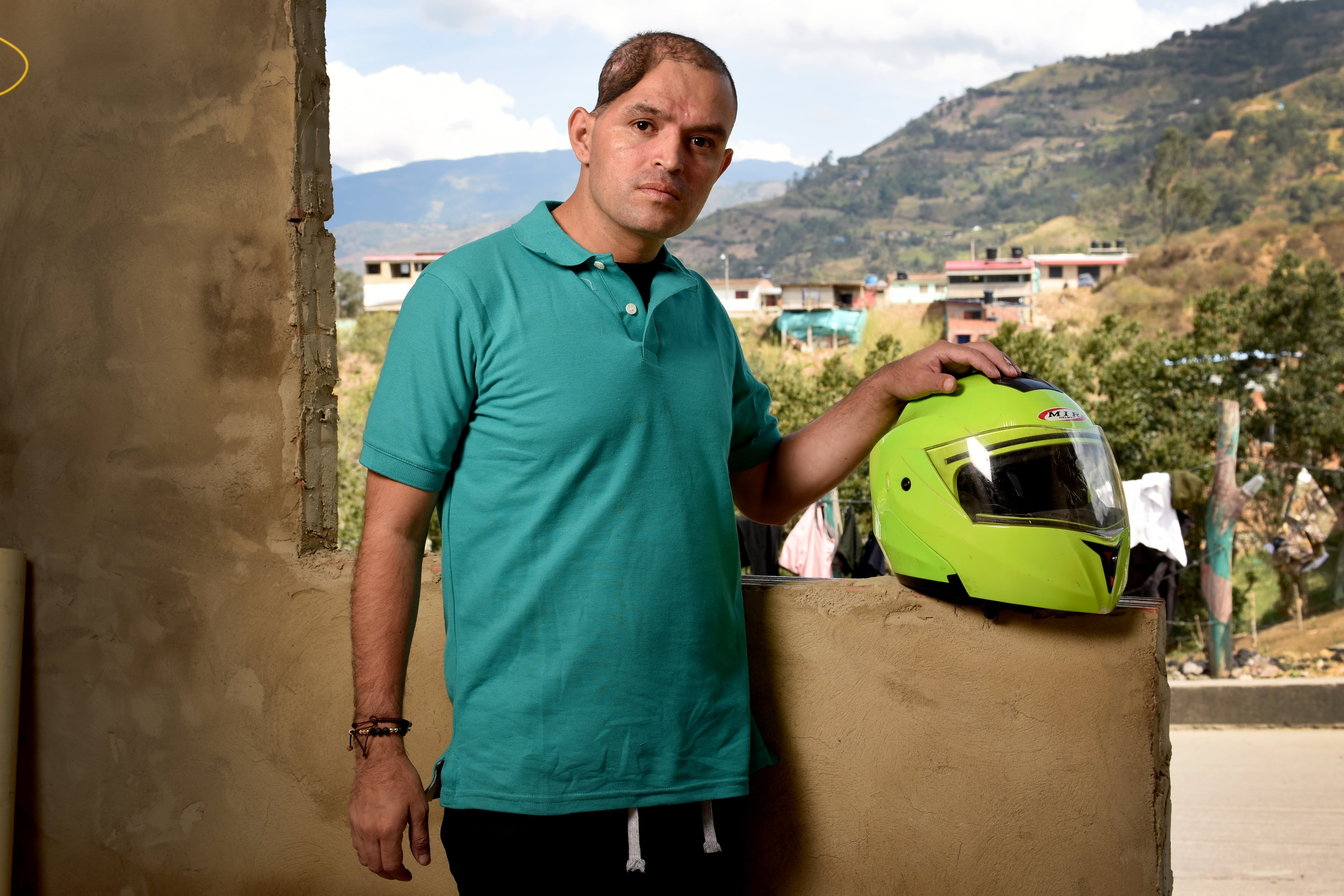 El patrullero de la Policía Harvey Ardila conmovió a Colombia luego de que el 21 de septiembre de 2021, sobre la medianoche, cuando realizaba un registro a dos hombres que se movilizaban cerca al parque Guacamayas de Bogotá, recibiera el disparo que le propinó una de las personas que estaba registrando en ese momento.