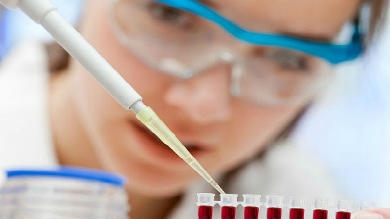 Esta clase de biopsia líquida es menos invasiva que la tradicional biopsia de tejido