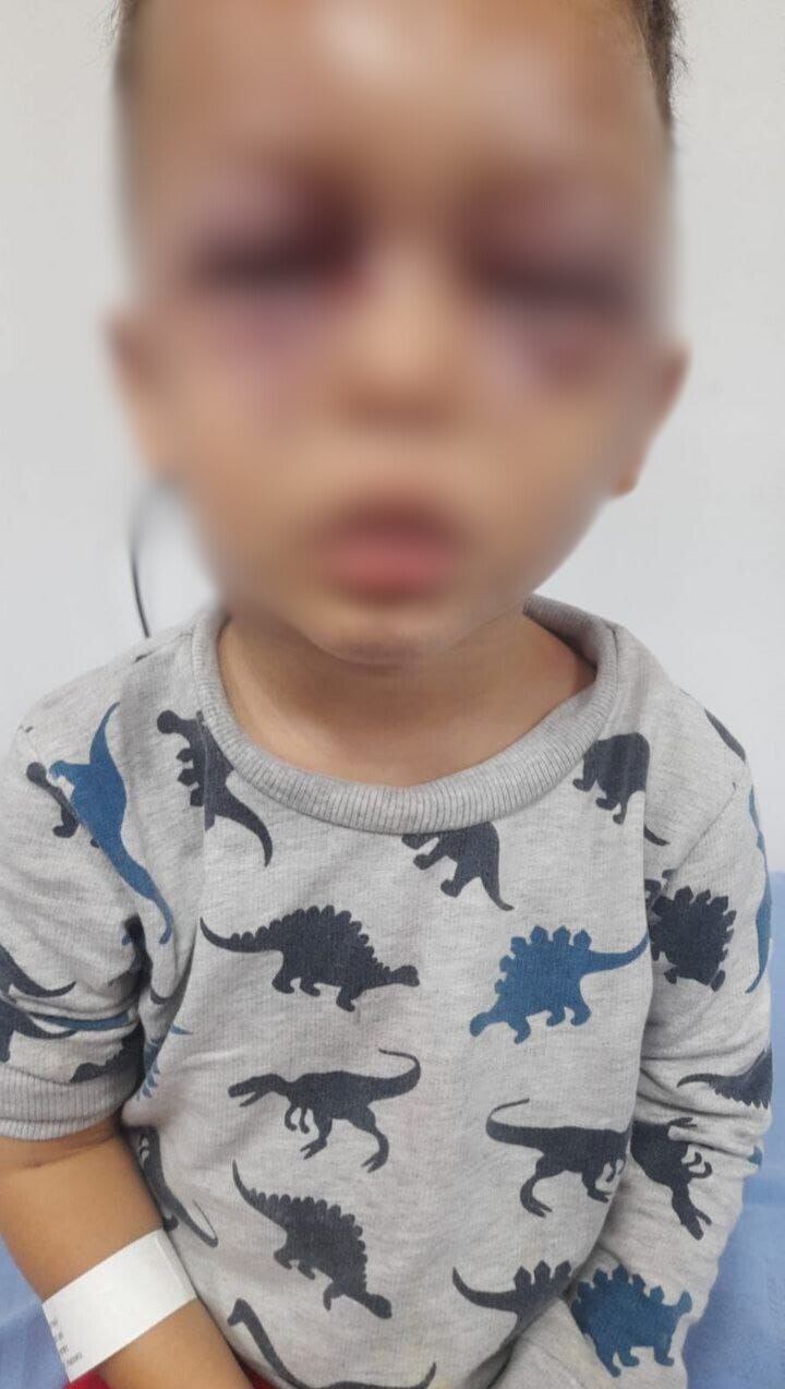 Menor de tres años fue golpeado por su padrastro