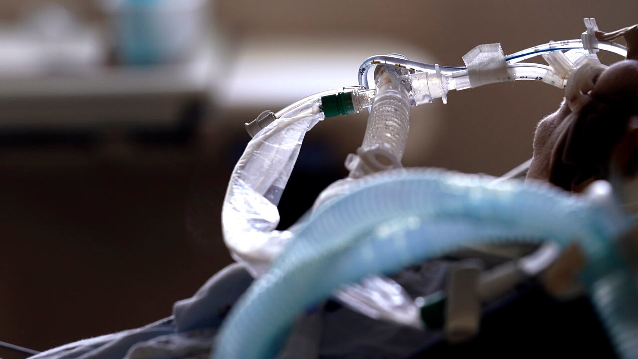 (AP Photo/Gerald Herbert, File)