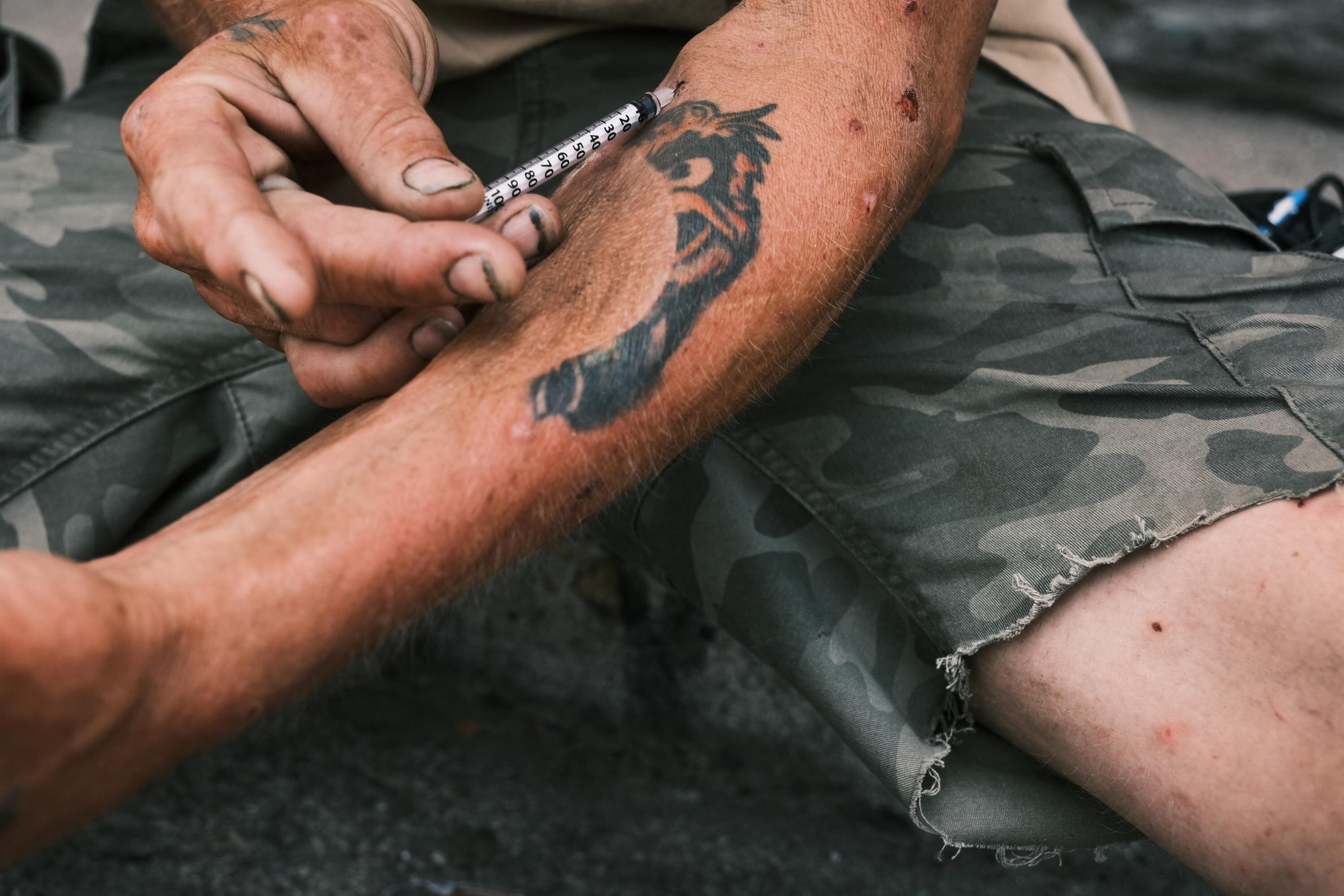 El riesgo del fentanilo en el mundo es que muchos de los adictos pueden llegar a consumirlo creyendo que es heroína lo que se están inyectando.