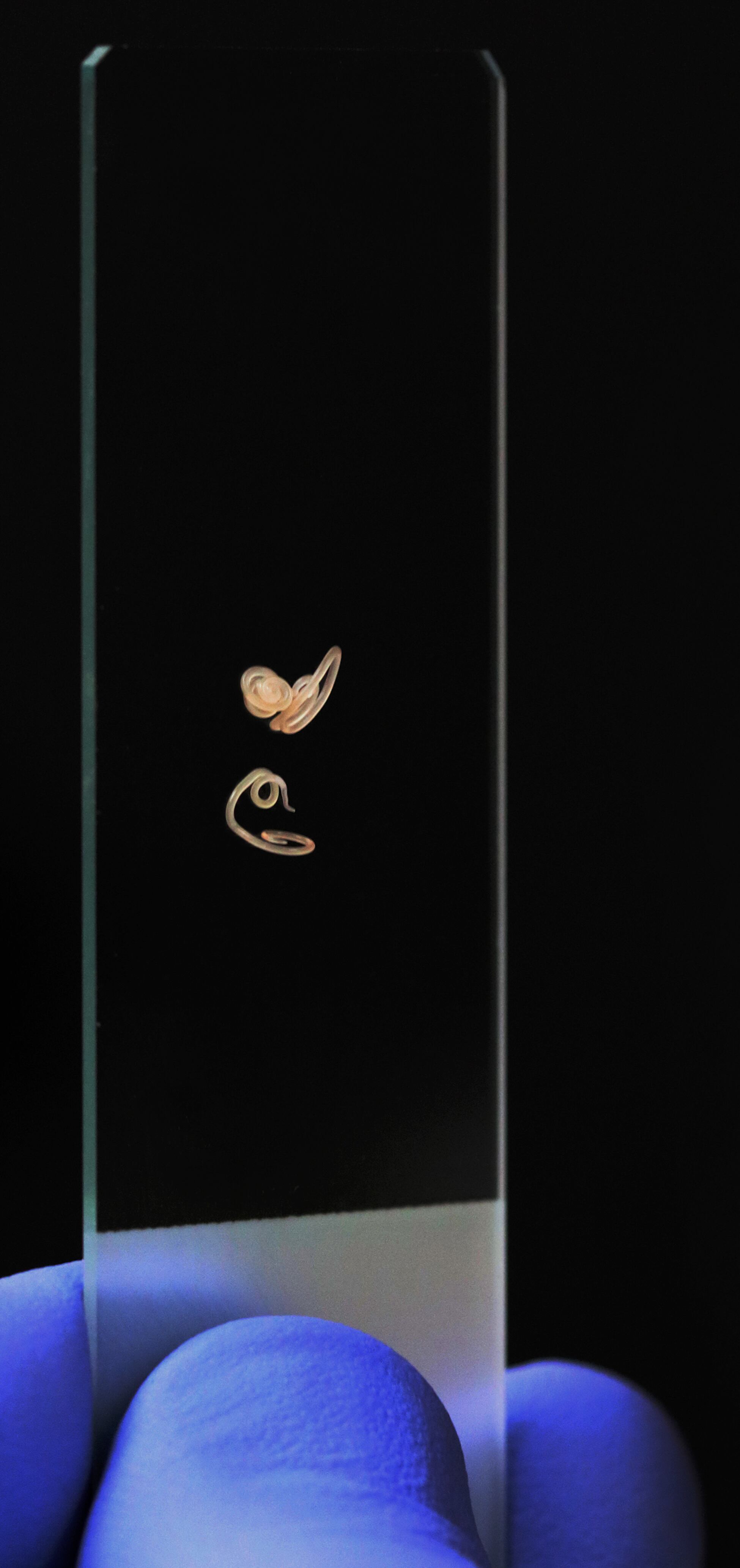 Parásitos intestinales