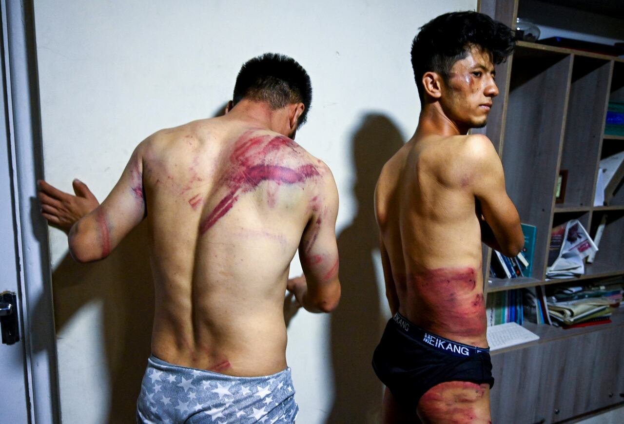 En esta imagen tomada el 8 de septiembre de 2021, los periodistas del periódico afgano Etilaat Roz, Nematullah Naqdi (izq.) Y Taqi Daryabi, muestran sus heridas en su oficina en Acceptance luego de ser liberados de la custodia de los talibanes. (Photo by Wakil KOHSAR / AFP) / TO GO WITH, 'Afghanistan-conflict-journalists', Focus by Emmanuel Duparcq