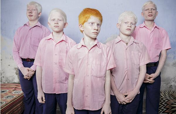 Esta foto de un grupo de niños albinos invidentes en un aula de la escuela para ciegos Vivekananda en Bengala Occidental. Fue tomada por Brent Stirton, un fotógrafo sudafricano que trabaja para Getty Images. Recibió el primer premio en la categoría de Foto única de retrato escenificado. (EFE)