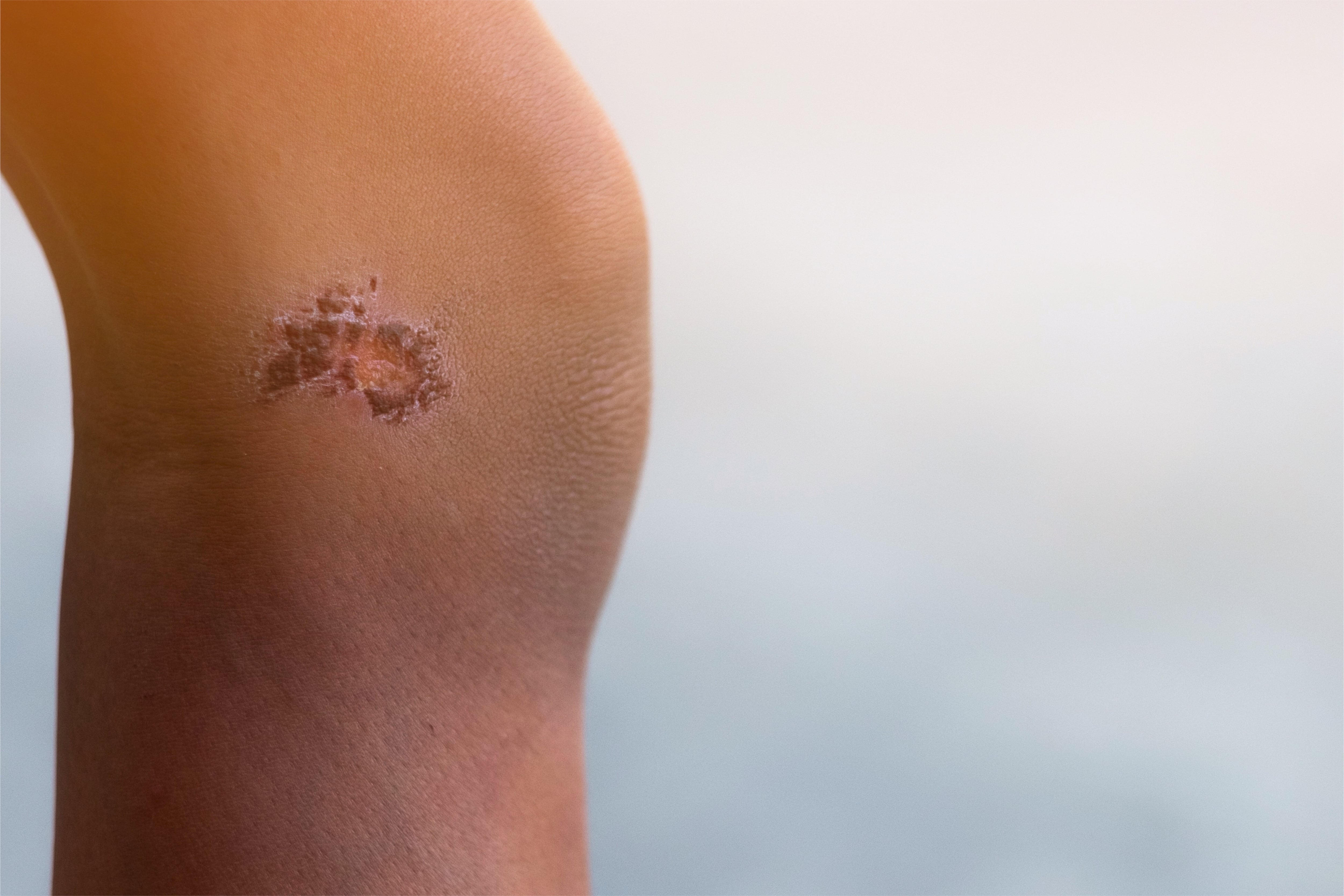 Afectaciones de la piel en producir