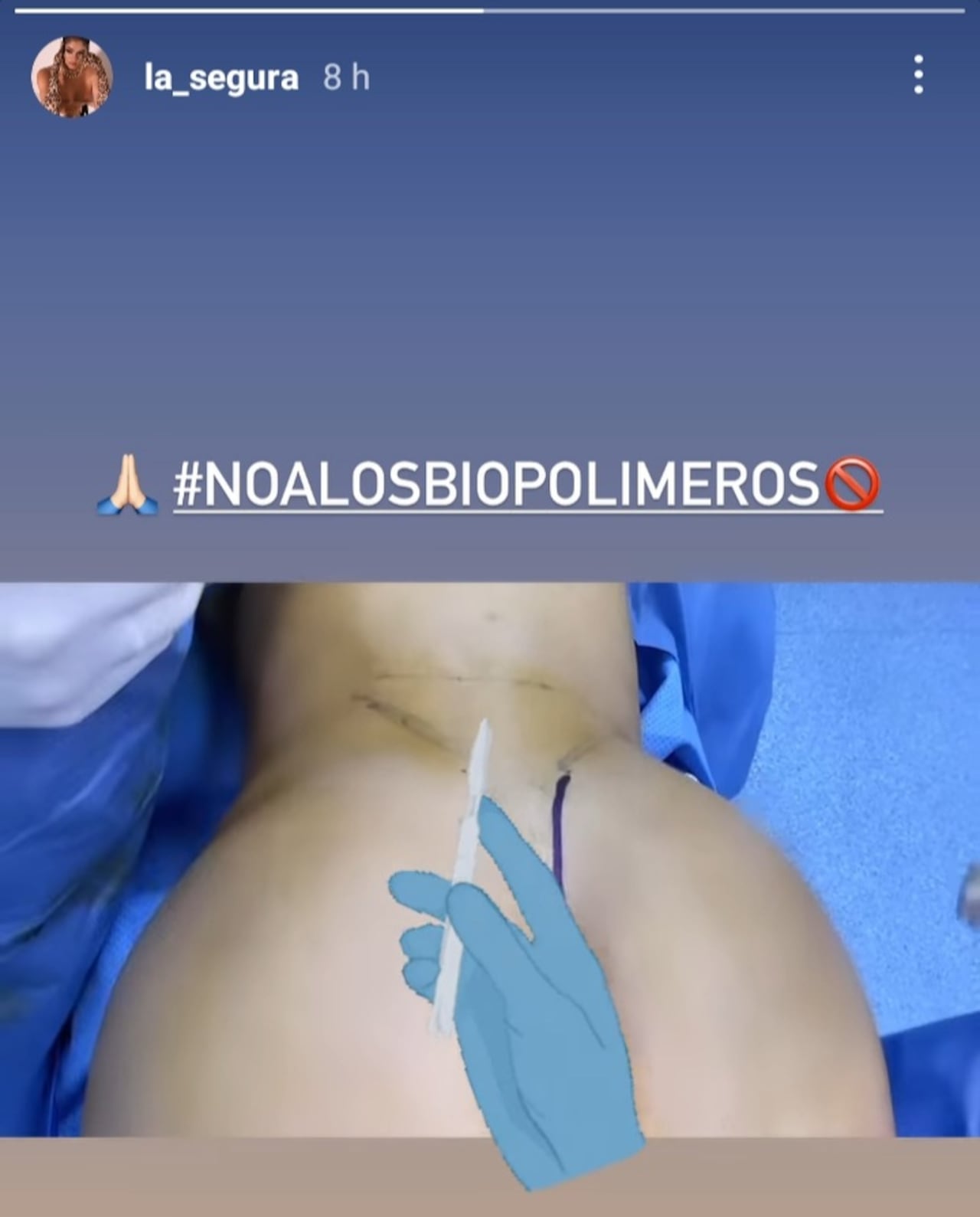 Procedimiento estético