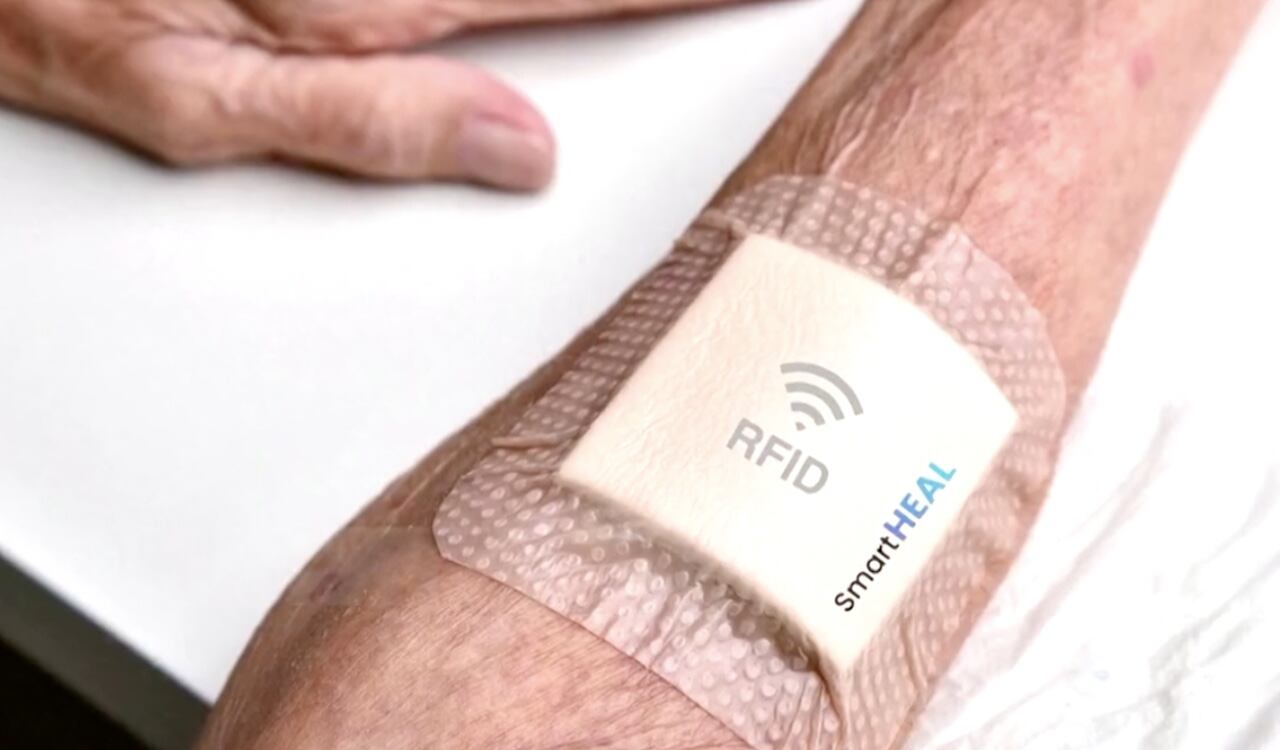 Los inventores explicaron que es un aporte a la ciencia que busca contribuir a poblaciones como la estadounidense, donde el 2,5% de su población sufre heridas crónicas que afectan su calidad de vida.