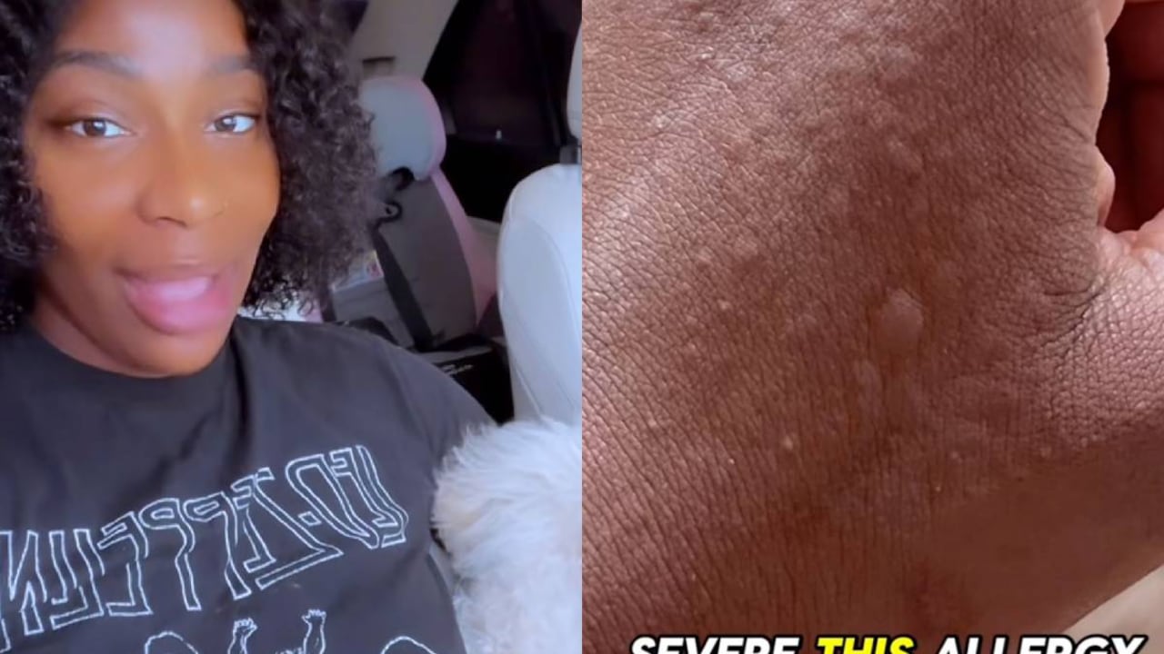 La mujer dio detalles de esta condición