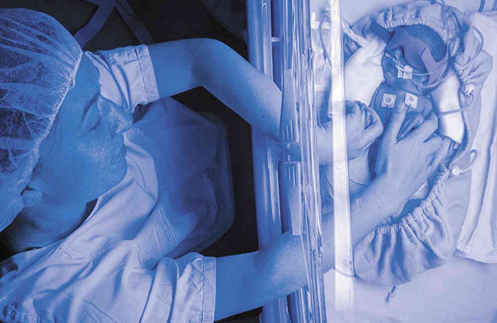 La fototerapia es el tratamiento más común para reducir los niveles de bilirrubina que causan ictericia en los recién nacidos. 