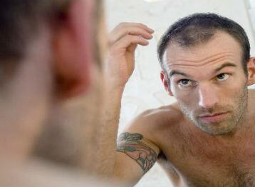 La alopecia puede producirse de repente o paulatinamente, afectando solo el cuero cabelludo o el cuerpo en general.